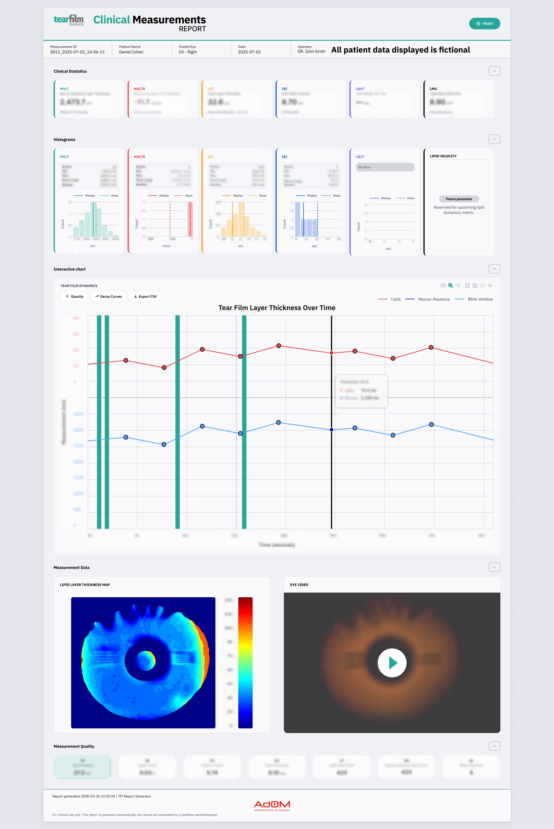 Redesigned clinical measurements report in light mode with examination graphs and eye layer analysis