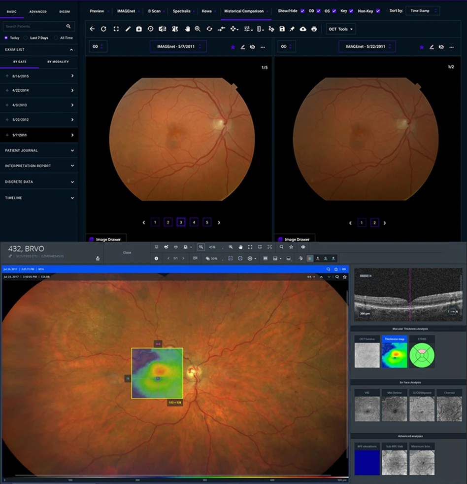 Dark clinical imaging interface used as inspiration for low-light environments